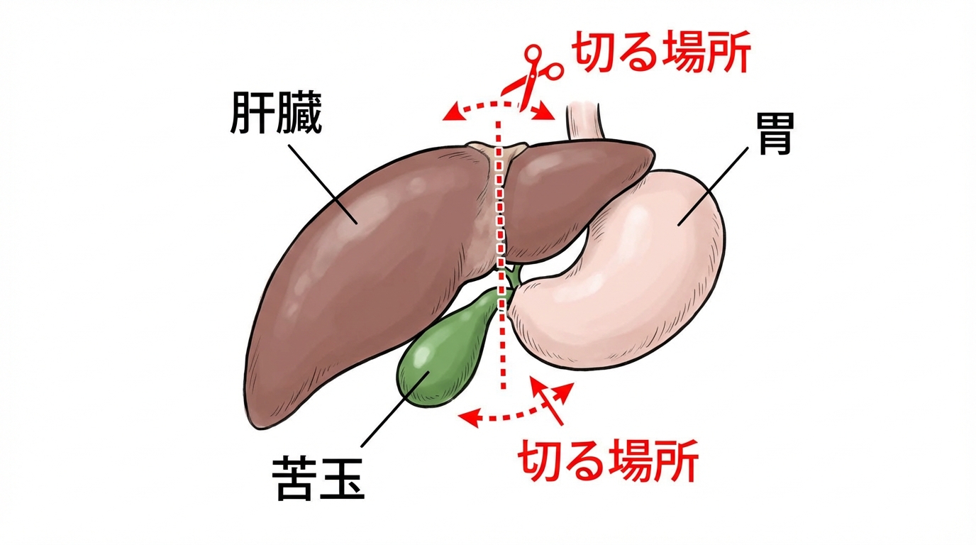 肝の構造とハサミを入れる位置の図解